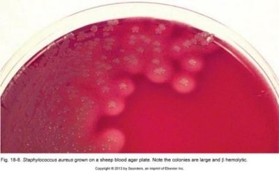 Staphylococcus aureus on blood agar showing large, beta-hemolytic colonies
