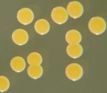 Staphylococcus aureus golden yellow colonies