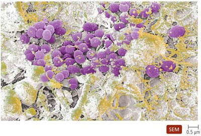 Dental plaque as a biofilm