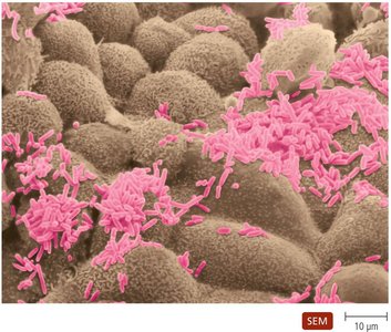 Bacteria colonizing human nasal cells