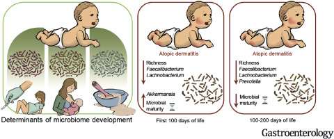 Determinants of microbiome development in infants