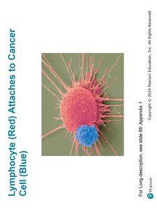 Lymphocyte (Red) Attaches to Cancer Cell (Blue)