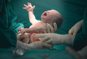 Newborn delivery and microbiota colonization