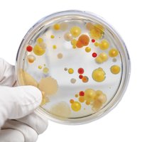 Petri dish and growth media