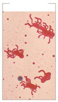 Flagella stain