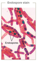 Endospore stain