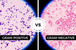 Gram-positive vs. Gram-negative bacteria