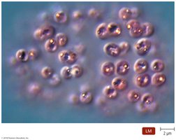 Sulfur deposits in purple sulfur bacteria