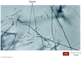 Branching filaments of actinomycetes