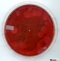 Blood agar plate showing hemolysis