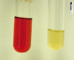 Methyl red test results: positive and negative