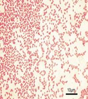 Gram-negative rods under microscope