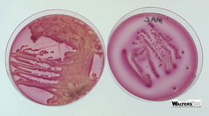 MacConkey agar with lactose fermenter and non-fermenter