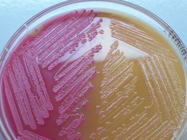 MacConkey agar close-up of lactose fermenter