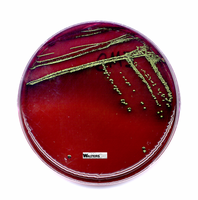 EMB agar with metallic green sheen