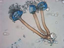 Rhizopus sporangia under microscope