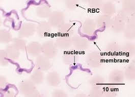Trypanosoma gambiense in blood smear