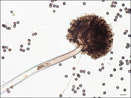 Aspergillus conidiophore
