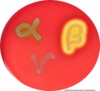 Hemolysis on blood agar plate: alpha, beta, gamma hemolysis