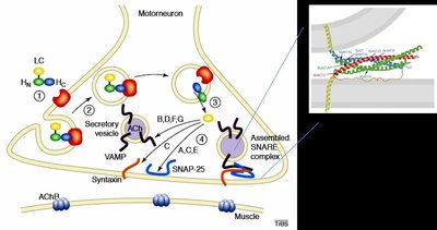 Pseudomembrane in diphtheria patient