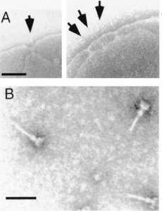 TEM of Type 3 Secretion System