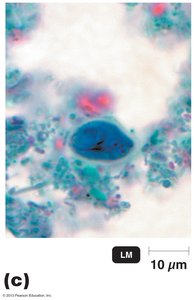 Light micrograph of Giardia cyst