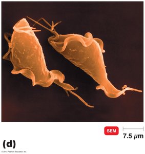 SEM of Trichomonas vaginalis