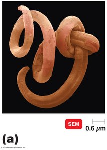 SEM of adult pinworm Enterobius vermicularis
