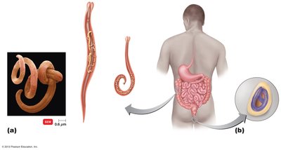Diagram of male and female pinworm anatomy and egg