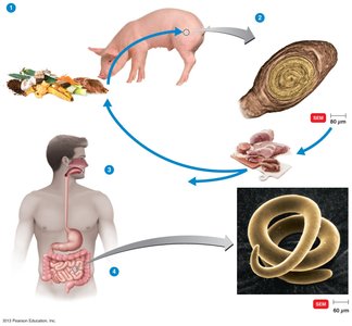 Life cycle of Trichinella spiralis (trichinellosis)