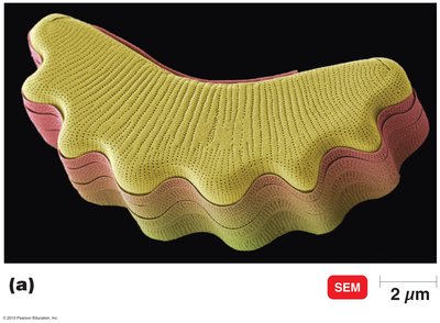 SEM of a diatom