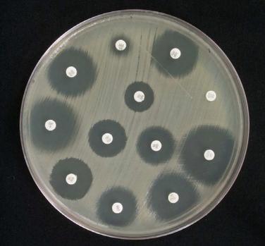 Disk-diffusion method showing zones of inhibition