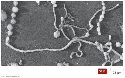 Pleomorphic forms of Mycoplasma pneumoniae under SEM