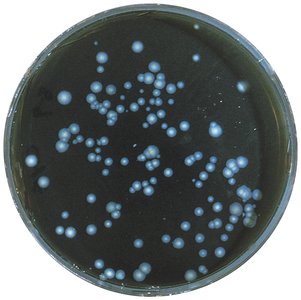 Legionella pneumophila colonies on selective agar