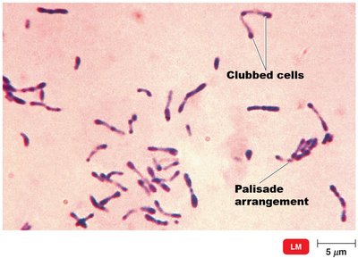 Corynebacterium diphtheriae under the microscope