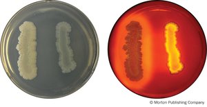 Starch Hydrolysis results