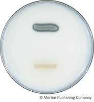 Casein Hydrolysis results