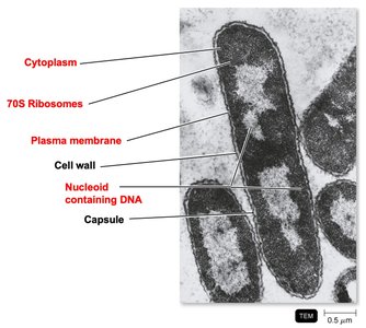 TEM of bacterial cell wall and internal structures