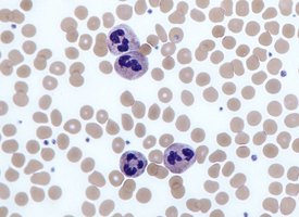 Neutrophils in blood smear