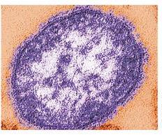 MMR vaccine impact on disease incidence