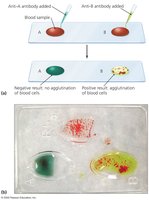 Hemagglutination blood typing test