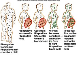 Rh incompatibility and hemolytic disease of the newborn