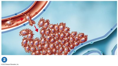 The pathogenesis of tuberculosis: early tubercle formation