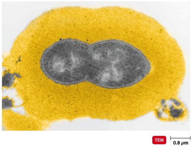 Streptococcus pneumoniae, the cause of pneumococcal pneumonia