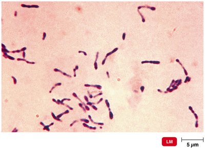 Corynebacterium diphtheriae, the cause of diphtheria