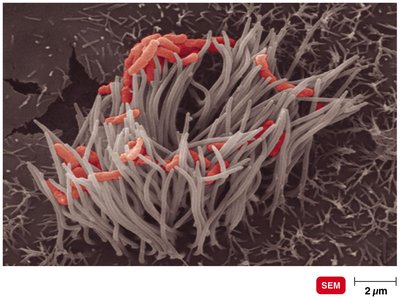 Ciliated cells of the respiratory system infected with Bordetella pertussis