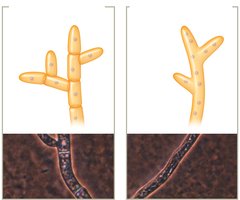 Septate and aseptate hyphae