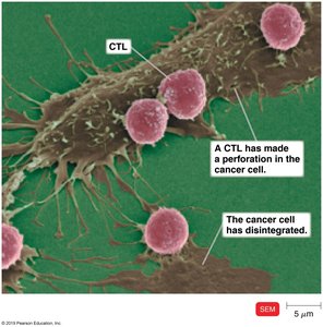 SEM image of CTL perforating and destroying a cancer cell