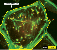 Listeria monocytogenes moving within a host cell using actin tails