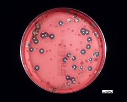 Blood agar plates showing beta, alpha, and gamma hemolysis by Streptococcus species
